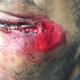 Illustration for article titled Bronx, NY, Man Allegedly Beaten by Pizzeria Employee With Wooden Pizza-Making Tool Demands Justice